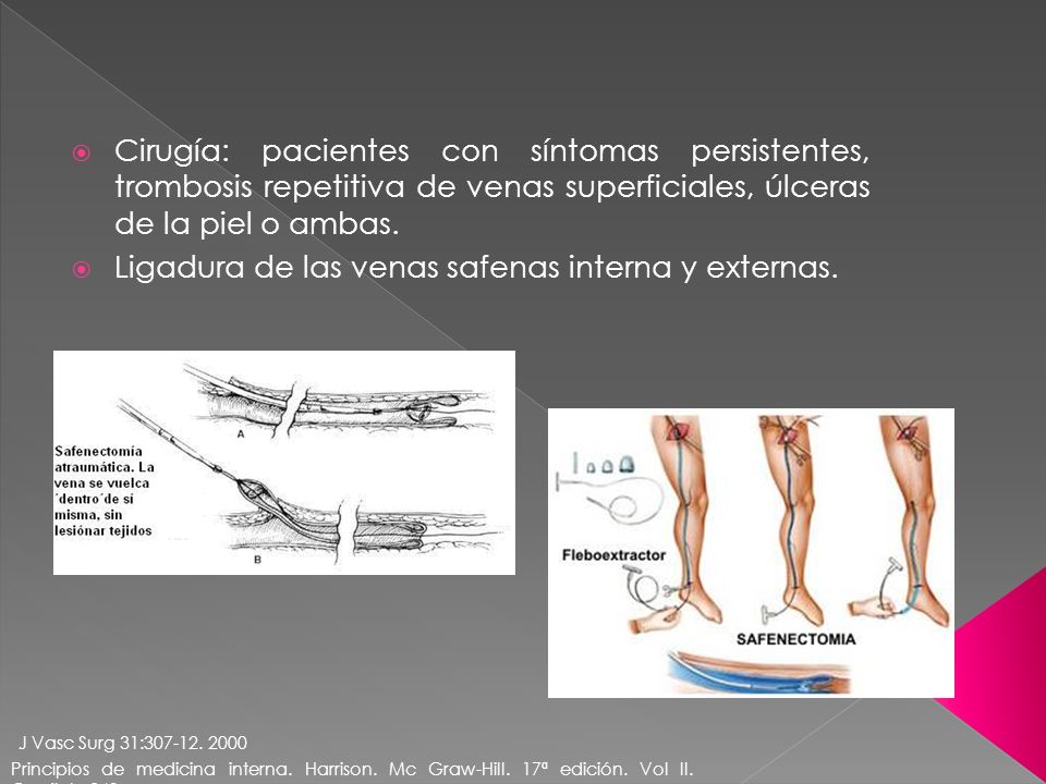 Piernas y tobillos hinchados ancianos